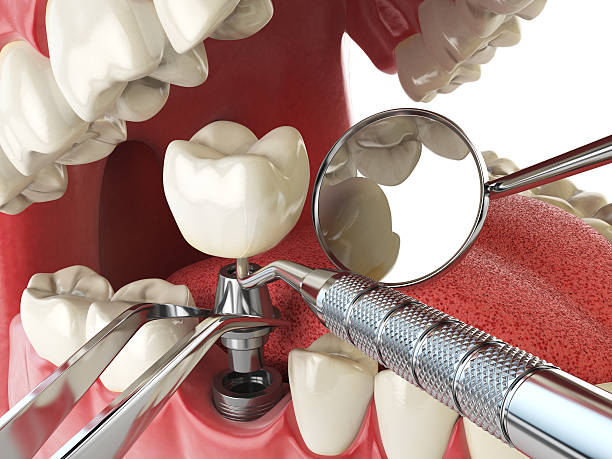Best Emergency Broken Tooth Repair in Southgate, KY
